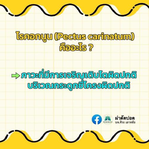 solve-doubts-pectus-carinatum-02