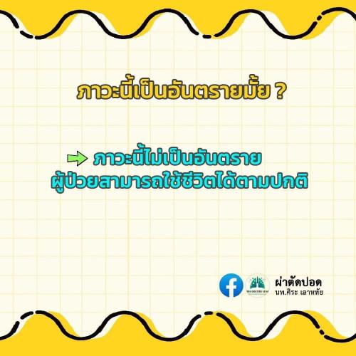 solve-doubts-pectus-carinatum-04