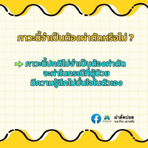 solve-doubts-pectus-carinatum-05