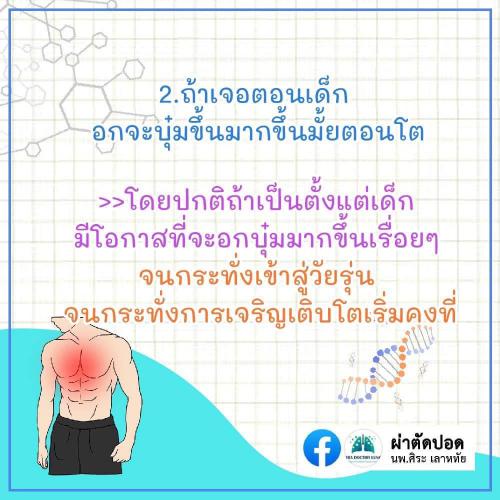 solve-doubts-pectus-excavatum-03