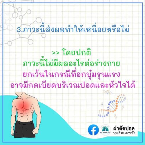 solve-doubts-pectus-excavatum-04
