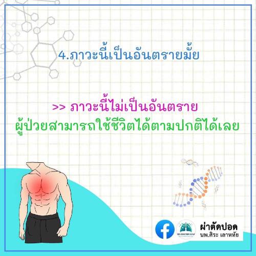 solve-doubts-pectus-excavatum-05