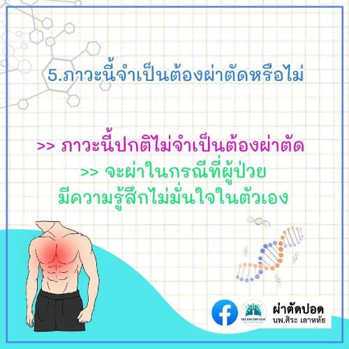 solve-doubts-pectus-excavatum-06