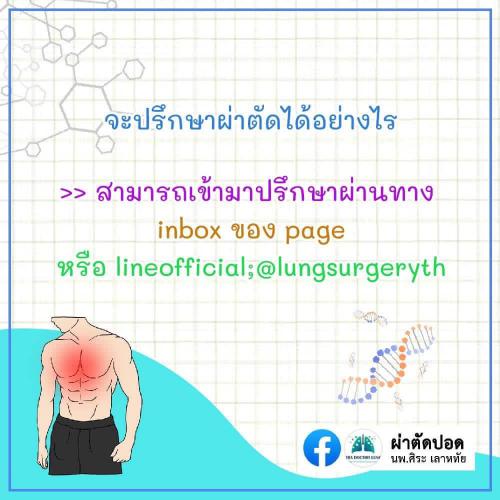 solve-doubts-pectus-excavatum-11